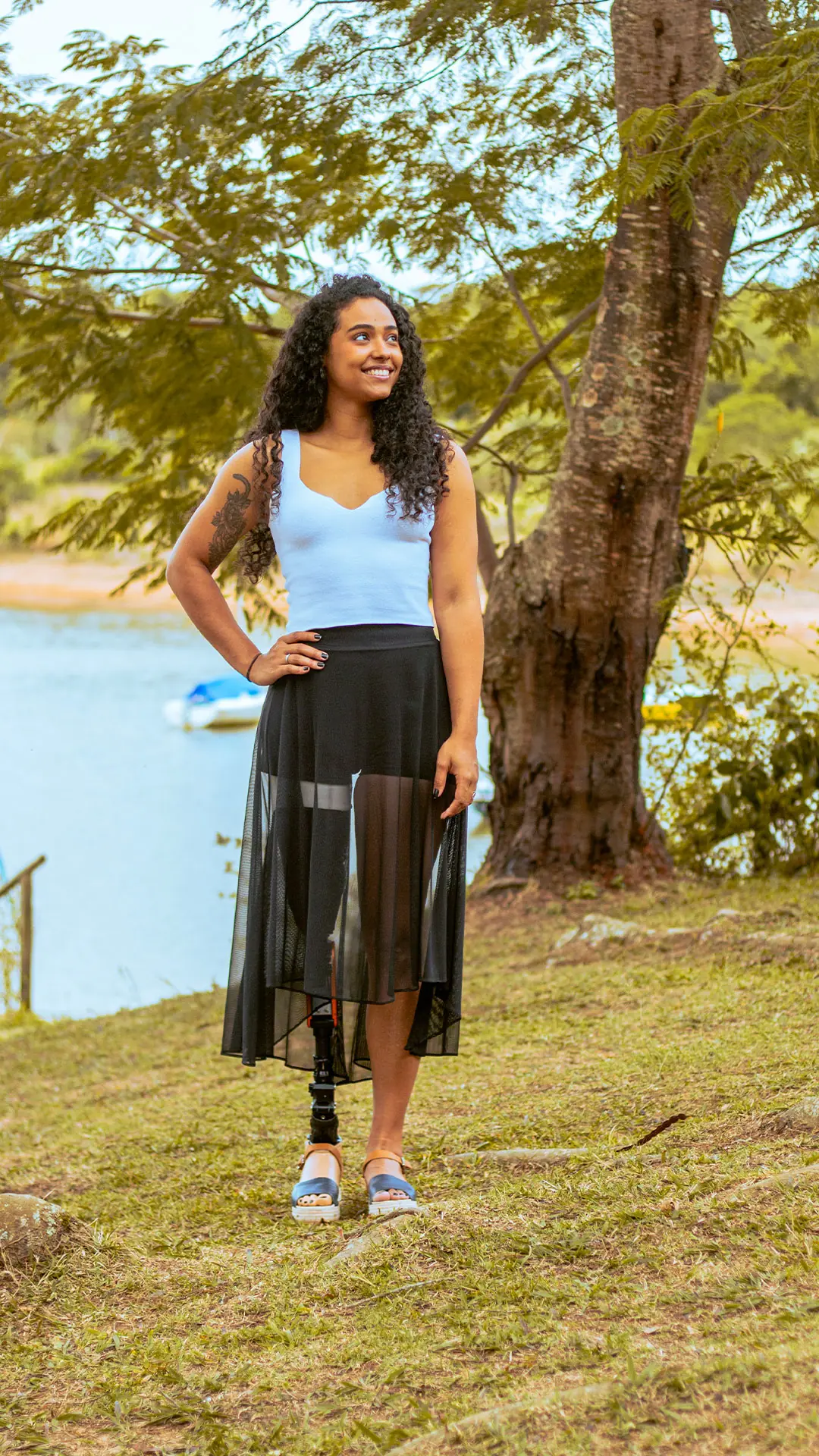 Woman in a skirt with a leg prosthesis, standing in a wooded area by the lake